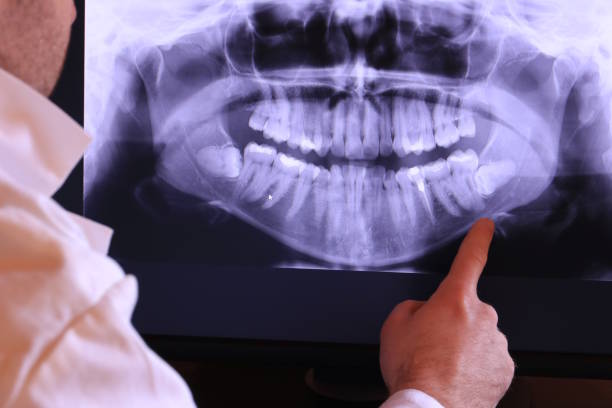 Best Emergency Root Canal Treatment in Winnsboro, TX